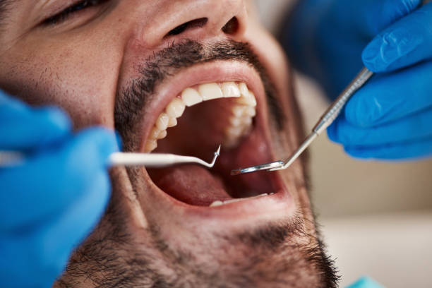 Best Orthodontic Emergency Dentist in Troy Hills, NJ