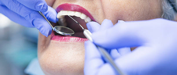 Best Emergency Root Canal Treatment in Troy Hills, NJ
